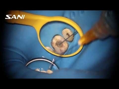 Fichiers Endo rotatifs dentaires de classe II, Instrument médical, 3 pièces/paquet